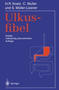 Abbildung von: Ulkusfibel - Springer
