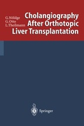 Cover: Cholangiography After Orthotopic Liver Transplantation - Springer