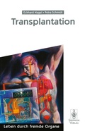 Cover: Transplantation - Springer