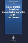 Bild: Single-Photon-Emissions-Computertomographie (SPECT) des Herzens - Springer