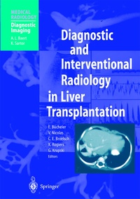 Abbildung von: Diagnostic and Interventional Radiology in Liver Transplantation - Springer