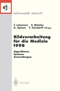 Cover: Bildverarbeitung f&uuml;r die Medizin 1998 - Springer