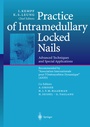 Cover: Practice of Intramedullary Locked Nails - Springer
