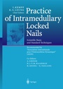 Cover: Practice of Intramedullary Locked Nails - Springer