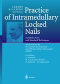 Cover: Practice of Intramedullary Locked Nails - Springer