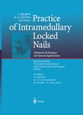Cover: Practice of Intramedullary Locked Nails - Springer