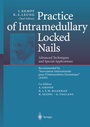 Cover: Practice of Intramedullary Locked Nails - Springer
