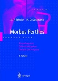 Abbildung von: Morbus Perthes - Springer