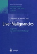 Cover: Liver Malignancies - Springer