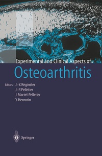 Abbildung von: Osteoarthritis - Springer