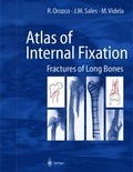 Cover: Atlas of Internal Fixation - Springer