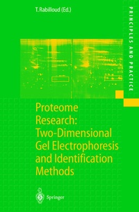 Abbildung von: Proteome Research: Two-Dimensional Gel Electrophoresis and Identification Methods - Springer