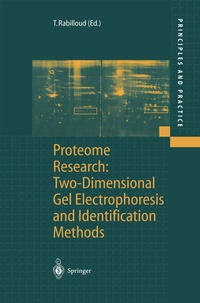 Abbildung von: Proteome Research: Two-Dimensional Gel Electrophoresis and Identification Methods - Springer