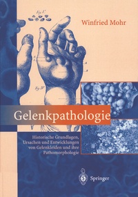Abbildung von: Gelenkpathologie - Springer