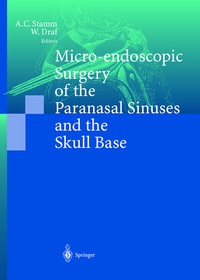 Abbildung von: Micro-endoscopic Surgery of the Paranasal Sinuses and the Skull Base - Springer