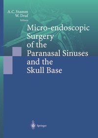 Abbildung von: Micro-endoscopic Surgery of the Paranasal Sinuses and the Skull Base - Springer