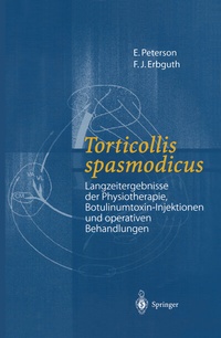 Abbildung von: Torticollis spasmodicus - Springer