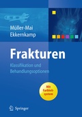 Cover: Frakturen - Springer