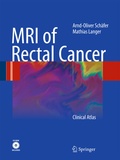 Cover: MRI of Rectal Cancer - Springer