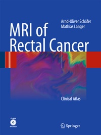 Abbildung von: MRI of Rectal Cancer - Springer