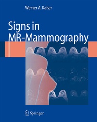 Enlarge image Cover: Signs in MR-Mammography - Springer
