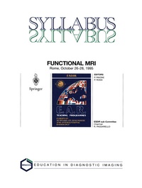 Abbildung von: Functional MRI - Springer