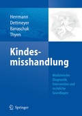 Cover: Kindesmisshandlung - Springer