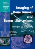 Cover: Imaging of Bone Tumors and Tumor-Like Lesions - Springer