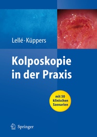 Bild vergrößern Bild: Kolposkopie in der Praxis - Springer