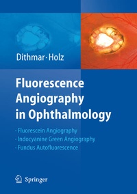 Enlarge image Cover: Fluorescence Angiography in Ophthalmology - Springer