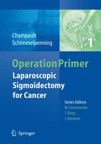 Enlarge image Cover: Laparoscopic Sigmoidectomy for Cancer - Springer