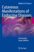 Cover: Cutaneous Manifestations of Endocrine Diseases - Springer