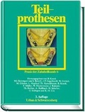 Cover: Praxis der Zahnheilkunde - PdZ. Strukturiert nach dem PermaNova-Verfahren / Teilprothesen - Urban & Fischer