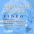 Cover: &Auml;sthetische Chirurgie Video II - ecomed-Storck
