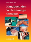 Abbildung von: Handbuch der Verbrennungstherapie - ecomed Storck