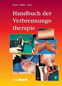Abbildung von: Handbuch der Verbrennungstherapie - ecomed Storck