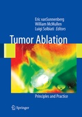 Cover: Tumor Ablation - Springer