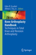 Cover: Knee Arthroplasty Handbook - Springer