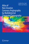 Cover: Atlas of Non-Invasive Coronary Angiography by Multidetector Computed Tomography - Springer