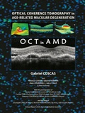 Cover: Optical Coherence Tomography in Age-Related Macular Degeneration - Springer