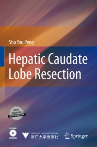 Abbildung von: Hepatic Caudate Lobe Resection - Springer