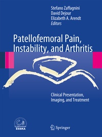Abbildung von: Patellofemoral Pain, Instability, and Arthritis - Springer