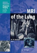 Cover: MRI of the Lung - Springer