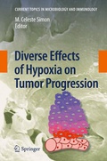 Bild: Diverse Effects of Hypoxia on Tumor Progression - Springer