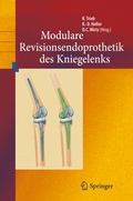 Cover: Revisionsendoprothetik des Kniegelenks - Springer