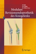 Cover: Revisionsendoprothetik des Kniegelenks - Springer