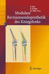 Abbildung von: Revisionsendoprothetik des Kniegelenks - Springer