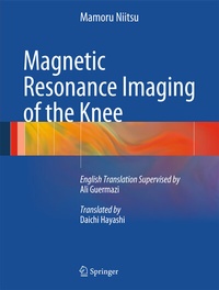 Abbildung von: Magnetic Resonance Imaging of the Knee - Springer