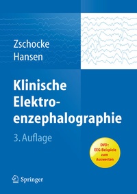 Abbildung von: Klinische Elektroenzephalographie - Springer