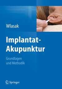 Abbildung von: Implantat-Akupunktur - Springer
